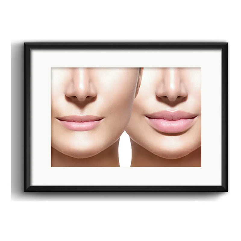 Cuadro Estetica Plastica Botox Lipo Clinica Arte Paspartu