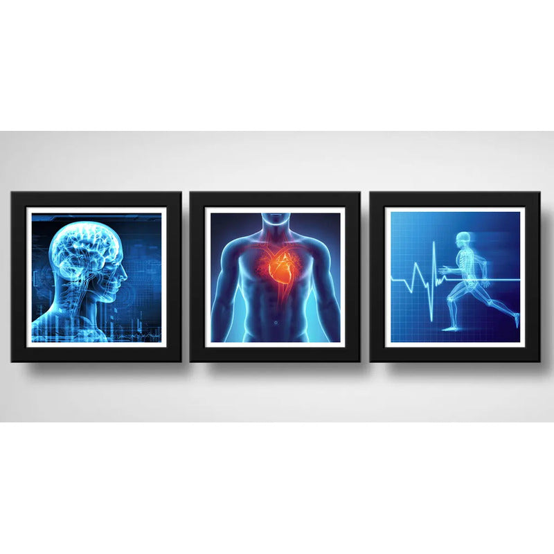 Set 3 Cuadros Medico Rayo X Anatomia Cuerpo Humano Clinica