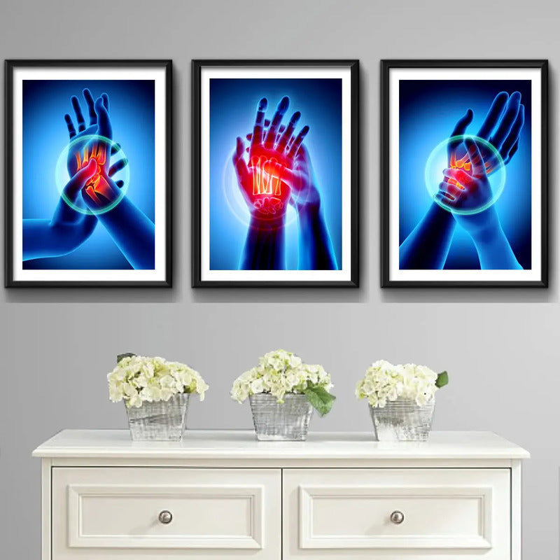 Set 3 Cuadros Ortopedia Manos Rayos X Cuerpo Humano Medicina