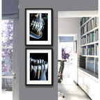 Set 2 Cuadros Implantes Dentales Dentista Clinica Paspartú
