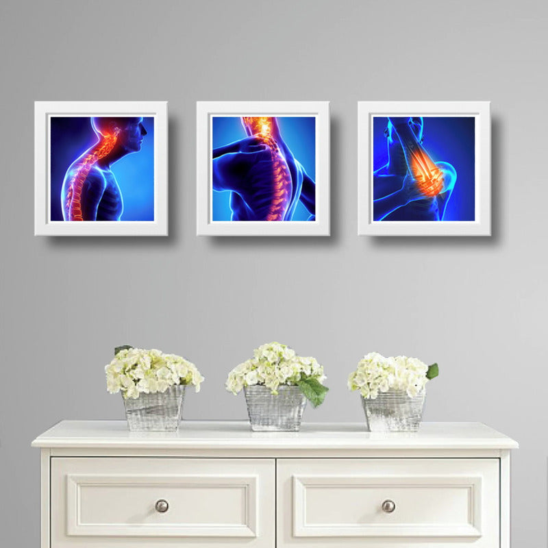 Set 3 Cuadros Ortopedia Rayos X Cuerpo Humano Clinica Medica