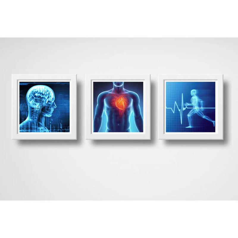 Set 3 Cuadros Medico Rayo X Anatomia Cuerpo Humano Clinica