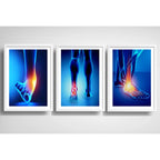 Set 3 Cuadros Ortopedia Piés Rayos X Cuerpo Humano Medicina