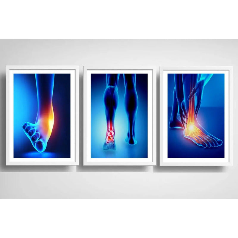 Set 3 Cuadros Ortopedia Piés Rayos X Cuerpo Humano Medicina