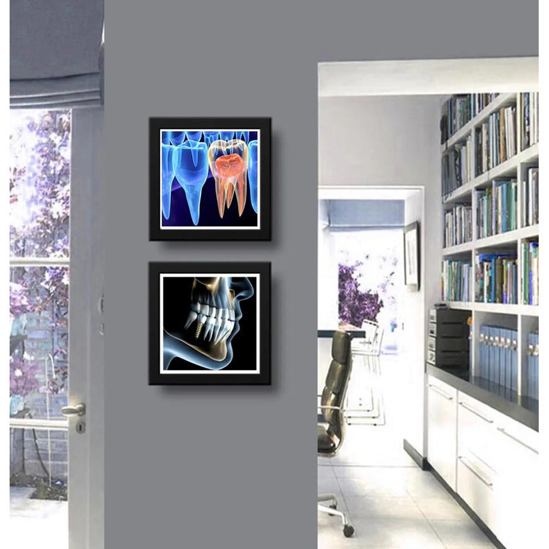 Set 2 Cuadros Implantes Dentales Dentista Clinica Decoracion
