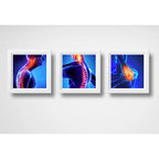 Set 3 Cuadros Ortopedia Rayos X Cuerpo Humano Clinica Medica