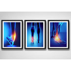 Set 3 Cuadros Ortopedia Piés Rayos X Cuerpo Humano Medicina