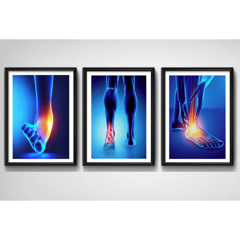 Set 3 Cuadros Ortopedia Piés Rayos X Cuerpo Humano Medicina