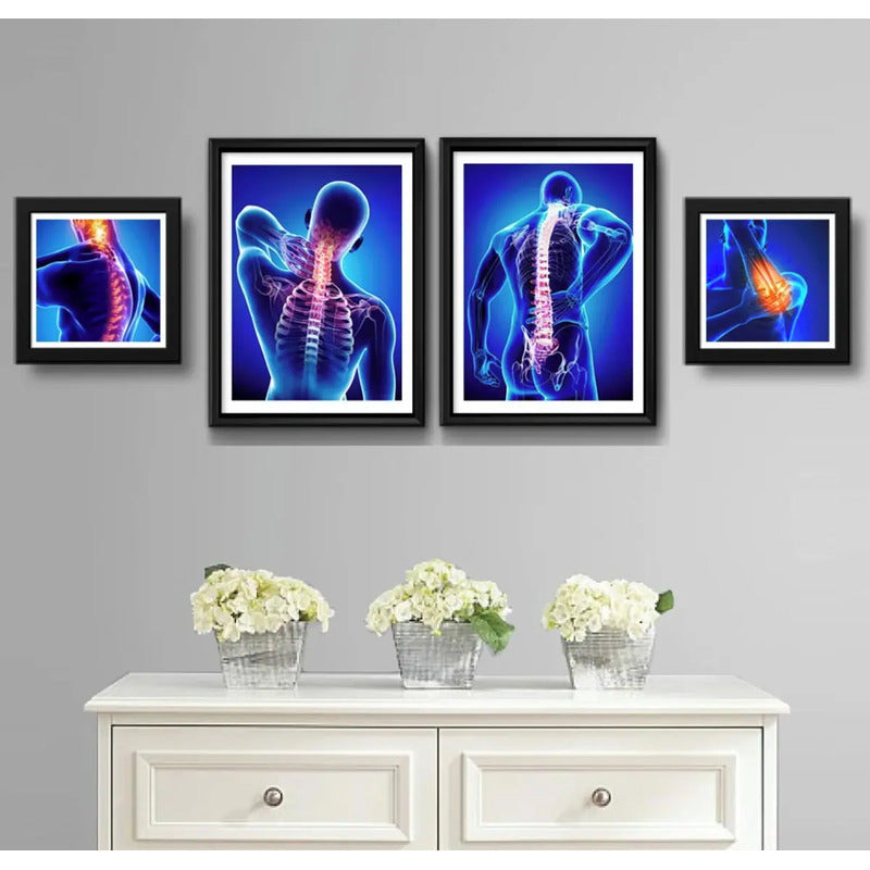 Set 4 Cuadros Ortopedia Rayos X Cuerpo Humano Clinica Medica