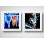 Set 2 Cuadros Implantes Dentales Dentista Clinica Decoracion