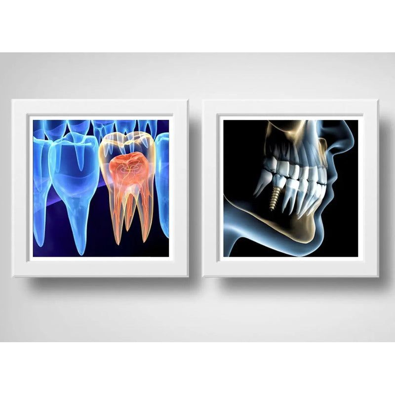 Set 2 Cuadros Implantes Dentales Dentista Clinica Decoracion