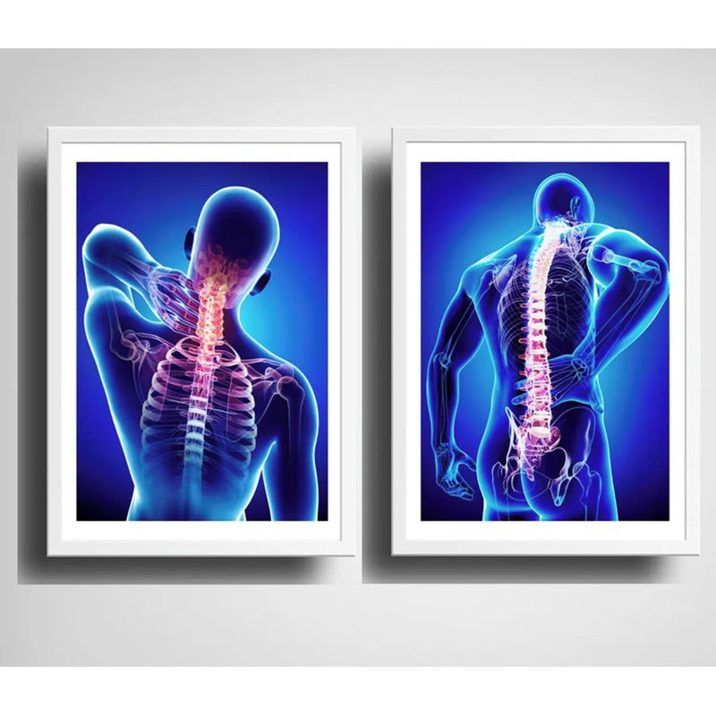 Set 2 Cuadros Ortopedia Médico Rayos X Cuerpo Humano Clinica